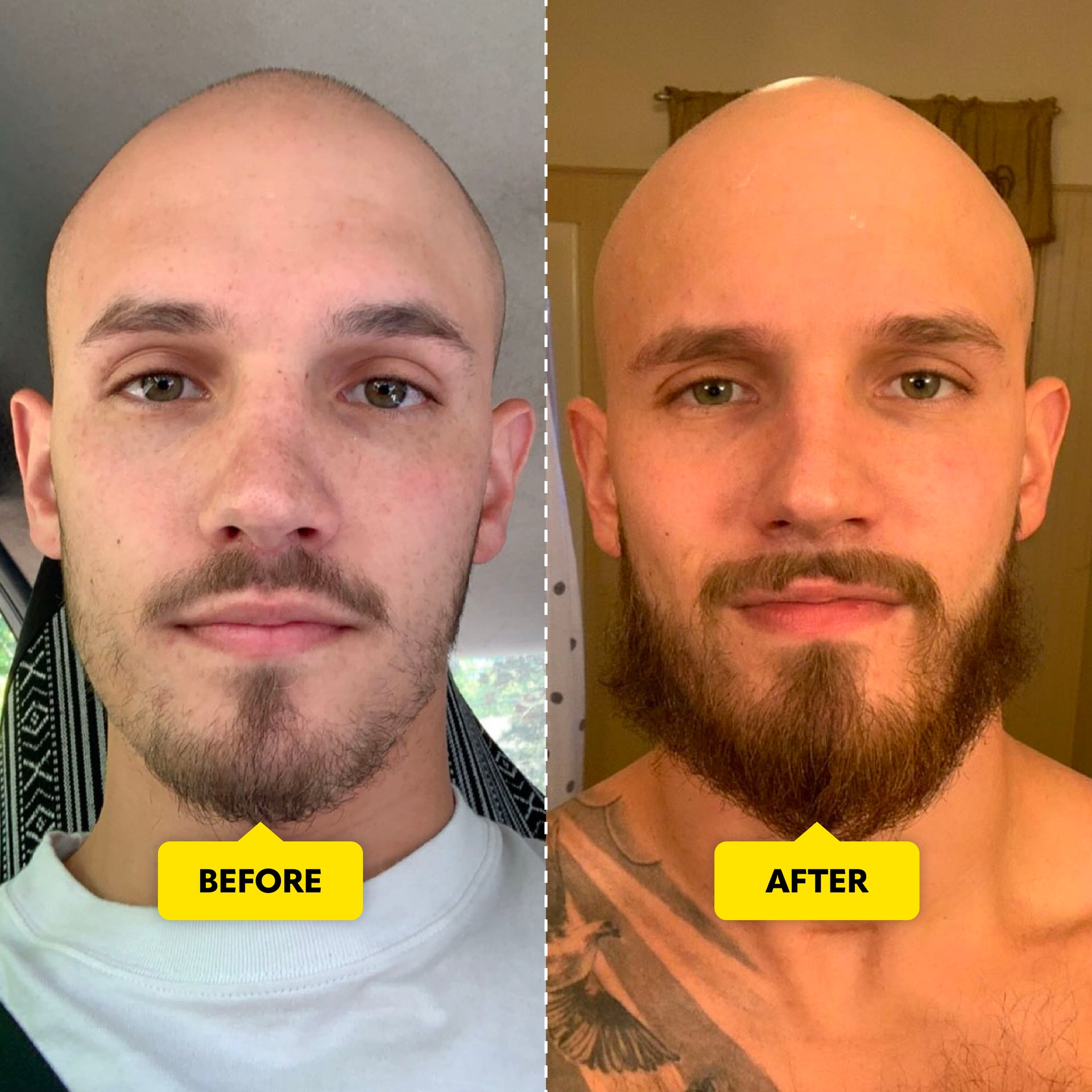 Beard Growth Vitamins