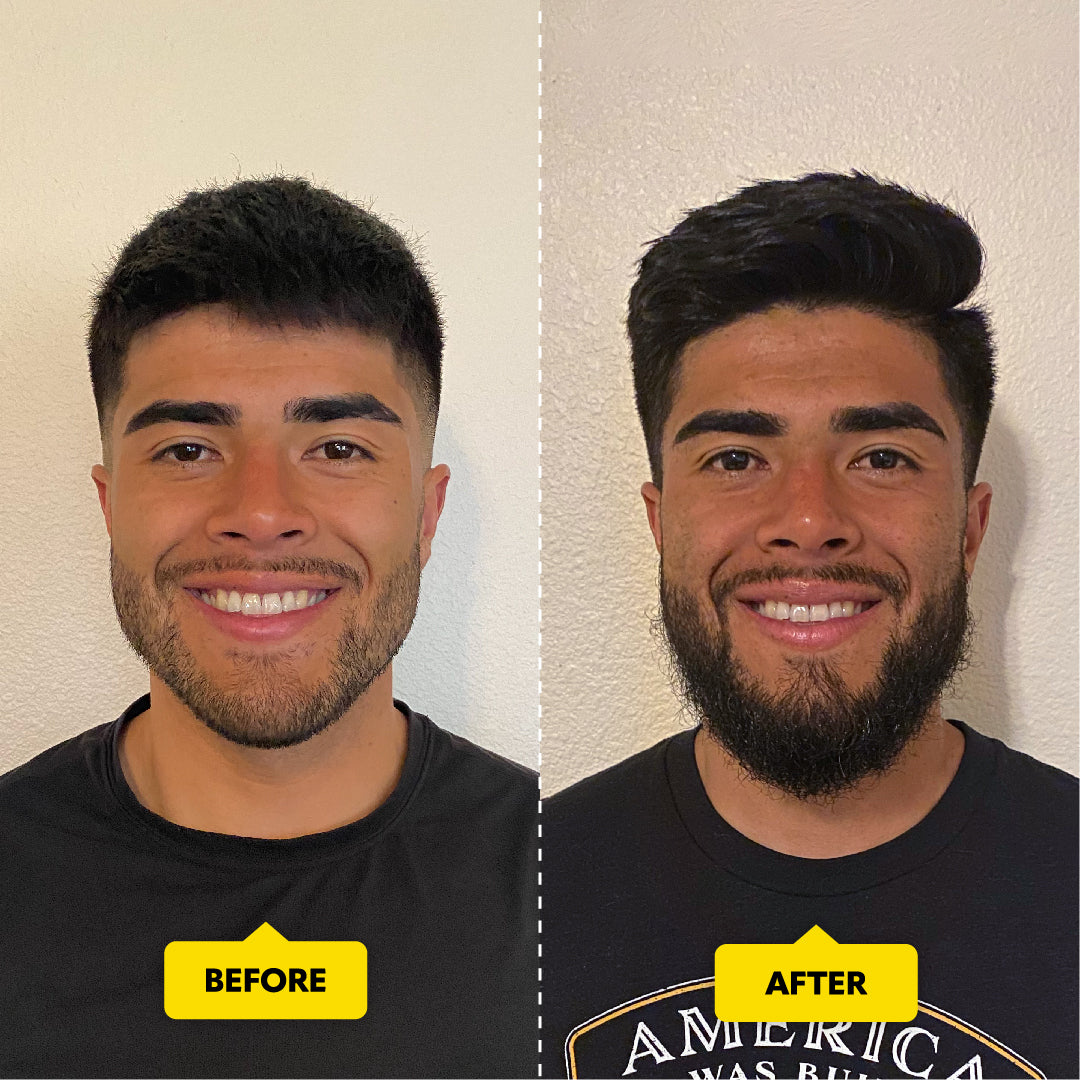 Starter Grooming Kit