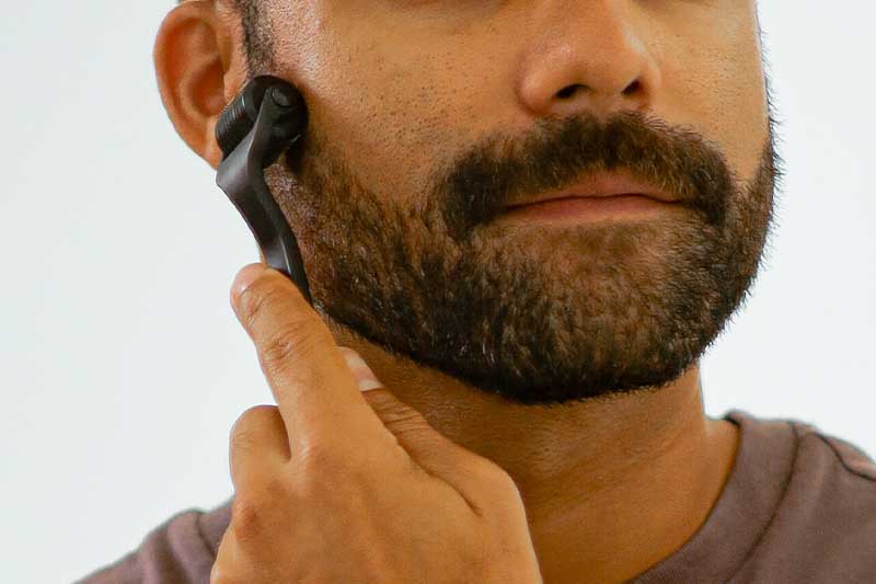 Man pressing a derma roller on his beard