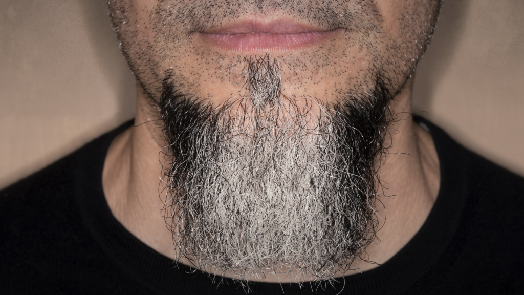 Man with stubble and goatee